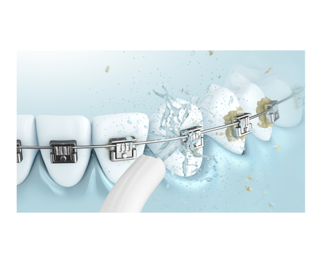 Replacement Nozzle for EW1211